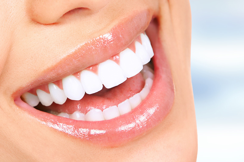 Cosmetic Dentistry in Madison